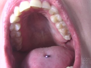 Hard Palate and Teeth