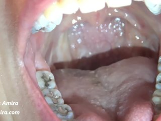 Teeth and Tongue Exploration