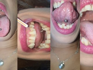 Tongue check and teeth cleaning