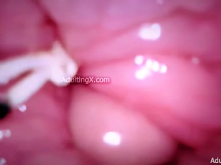 Camera in Vagina, Cervix POV, Tiny Cucked by Giant ‘Couple’, Cum in Condom and Creampie - Full Clip