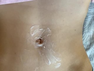White cream on my navel