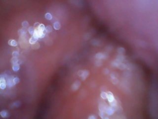 I put a camera inside my vagina to get my cervix POV