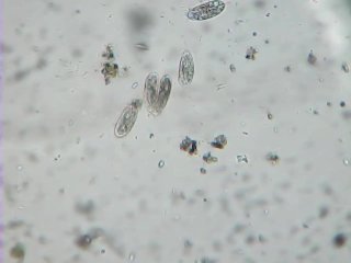 Watching Hairy Tiny Squishy cells Getting Separated (cell division of protozoa/ciliates)
