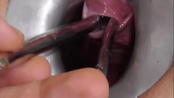 Amateur FreyjaAnalslut:  Multiple Sounds - James is stretching Freyja's urethra with multiple sounds - peeing into Freyja's gaping cunt