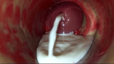 Camera Inside Deep Pussy Captures Huge Ejaculation of Sperm ASMR