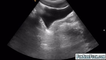 ULTRA SCAN revealed a HUGE Secret Hidden in His Belly! Grayson Cole examination of his colon by Legrand Wolf turned out to be an experience he would never forget!