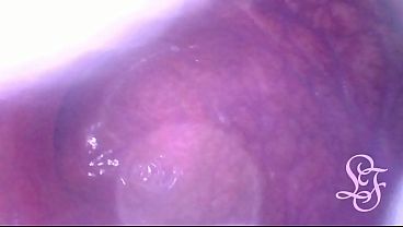 Look deep inside my ass!