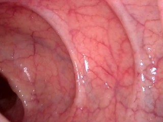 Take in the view peering up my descending colon